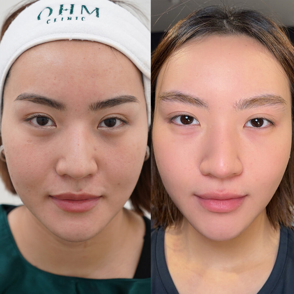 รีวิวsylfirm