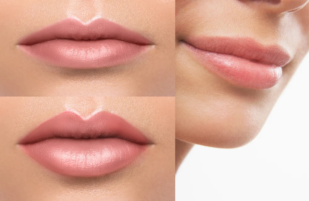 ฉีดปากทรงเกาหลี