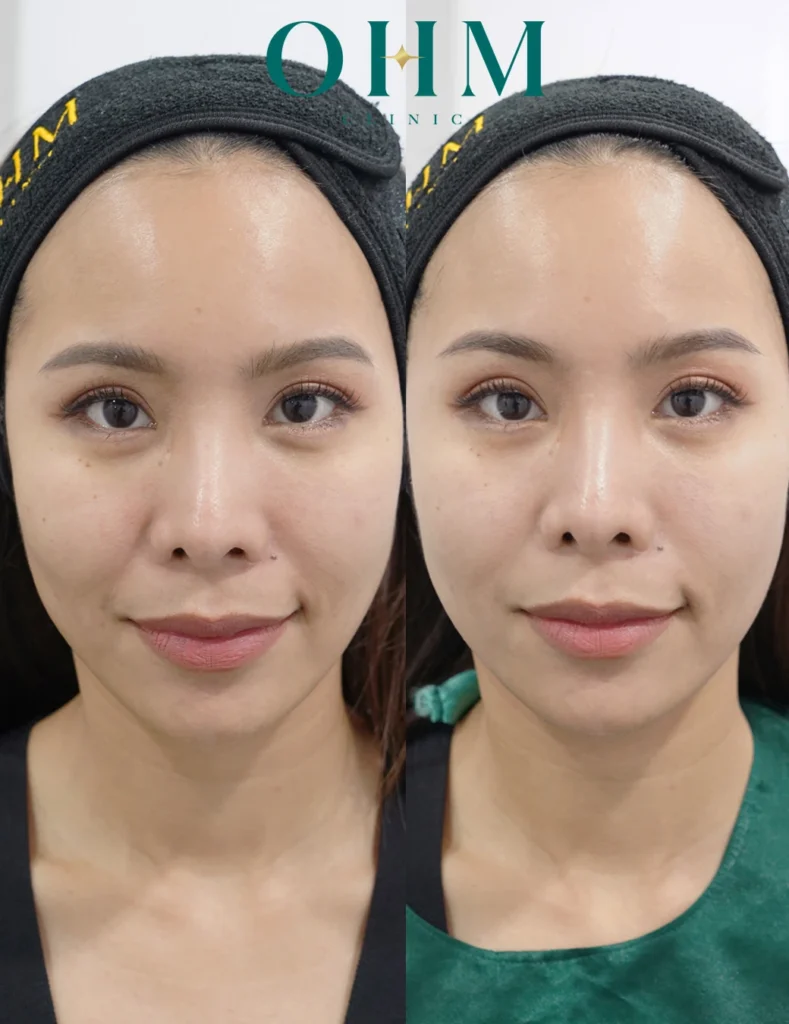 หน้าหย่อนคล้อย