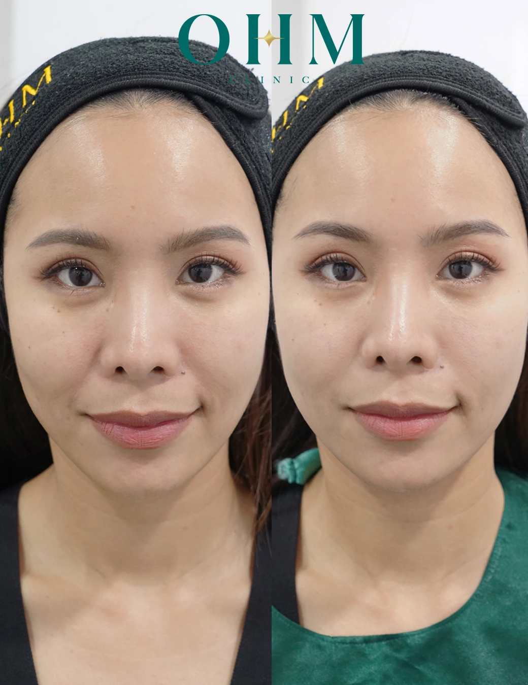 หน้าหย่อนคล้อย