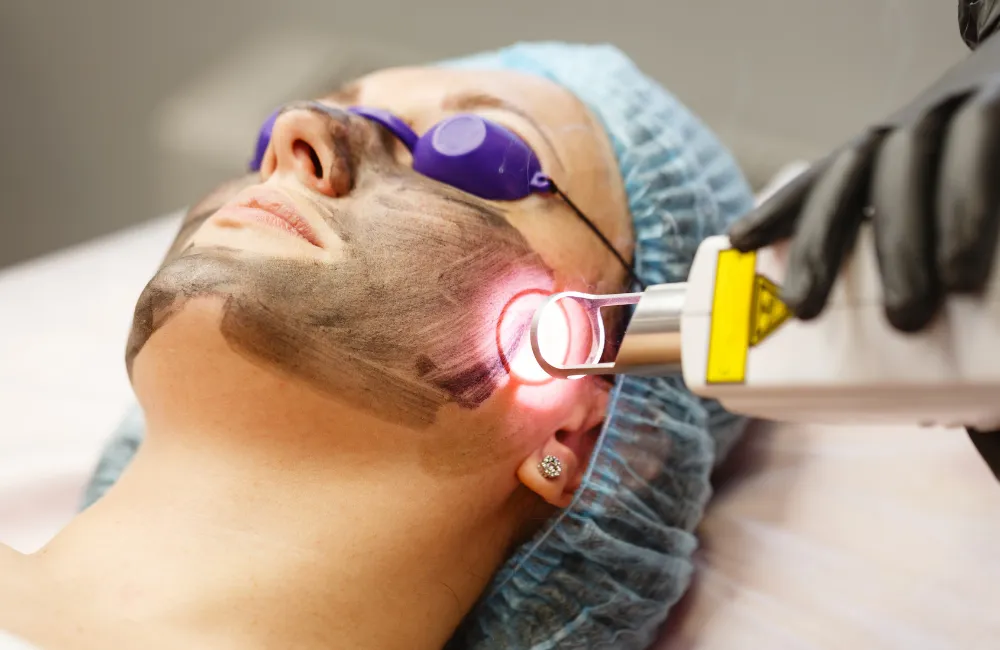 รักษาหลุมสิว