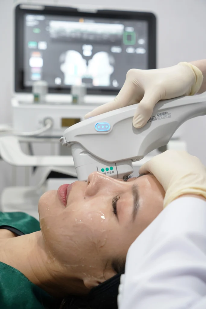 Ulthera ราคา