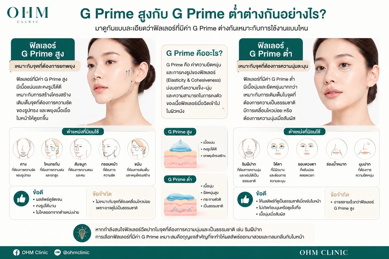 G Prime สูงต่ำ ต่างกันยังไง